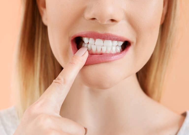 O femeie își arată dinții la dentist.