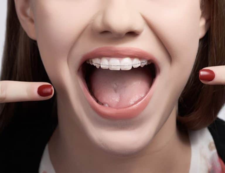 Un stomatolog care își arată dinții (dinti) camerei.